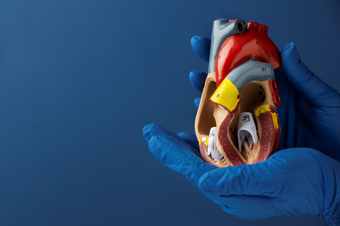valve cardiaque